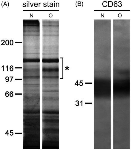 Figure 2. Protein composition of seminal prostasomes. Seminal prostasomes isolates were resolved on 10% SDS-PAGE under reducing and denaturing conditions and stained with silver or transferred onto a membrane and subjected to immuno-blot. A: A representative total protein pattern of seminal prostasomes with three characteristic bands (Citation12) in the region of 90–150 kDa (asterisk). B: CD63, an EVs-associated marker gave characteristic smeared band above 31 kDa. The numbers indicate the position of molecular mass standards (kDa). (N = seminal prostasomes from normozoospermic men; O = seminal prostasomes from oligozoospermic men).