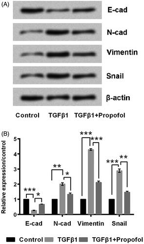 Figure 2. Propofol inhibits cell EMT. The cells were stimulated with 6 μg/mL propofol for 48 h. EMT was induced with 10 ng/mL TGFβ1 for 72 h. (A, B) Expression of EMT-related proteins by Western blot analysis. Data represented as mean ± SD. n = 3 per group. *p < .05; **p < .01; ***p < .001 compared to control group.