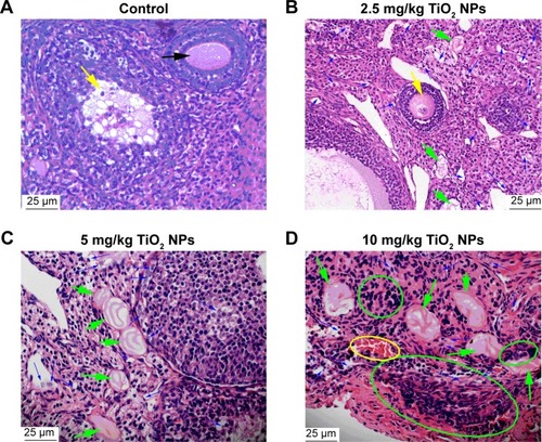 Figure 3 Histopathological examination of ovary of mice following gavage administration of TiO2 NPs for 30 days.Notes: (A) Control groups (unexposed mice) present normal development of primary follicles (black arrow) and secondary follicles (yellow arrow); (B) the 2.5 mg/kg TiO2 NP-exposed group shows atrophic secondary follicle (yellow arrow), primary follicle atresia (green arrow) and apoptosis of granule cells (blue arrow); (C) the 5 mg/kg TiO2 NP-exposed group shows large primary follicle atresia (green arrow) and granule cell apoptosis (blue arrow), and (D) the 10 mg/kg TiO2 NP-exposed group shows severe inflammatory cell infiltration (green circle), congestion (yellow circle), significant primary follicle atresia (green arrow) and disposed disorder or apoptosis of granule cells (blue arrow).Abbreviation: TiO2 NPs, titanium dioxide nanoparticles.