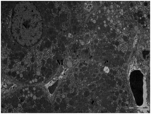 Figure 4. Transmission electron micrograph of hepatocytes obtained from the liver of control rats given water and food (N, nucleus; M, mitochondria).