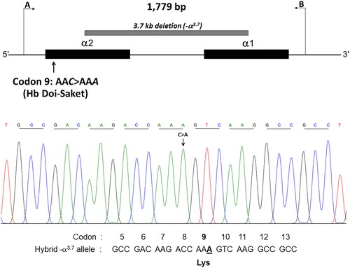 Figure 5. The hybrid -α3.7 gene and forward directional nucleotide sequence obtained from this gene. The arrow indicates nucleotide replacement.