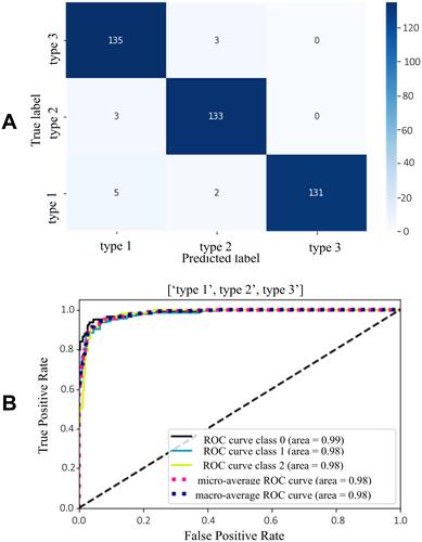 Figure 7 Test results of EfficientNetB0 model for cervix type classification (A) Confusion matrix (B) ROC-AUC plot.