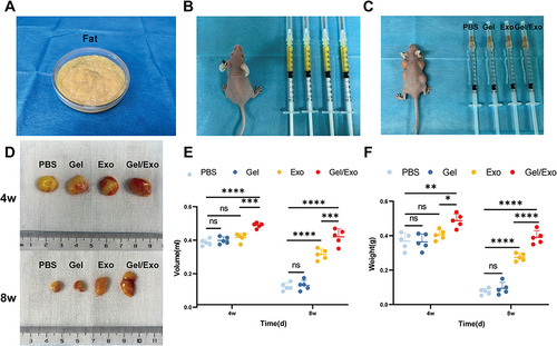 Figure 5 The process of transplantation. (A) Pre-cut fat. (B) Each nude mouse received a subcutaneous injection of fat (0.5 mL) at four dorsal sites. (C) PBS, PF-127 hydrogel, hASC-Exos, or PF-127 hydrogel/hASC-Exos were injected at four separate locations along the graft site in each mouse. (D) Representative images of the general morphology of the fat grafts after 4 and 8 weeks. (E) Weight of the fat grafts 4 and 8 weeks after transplantation. (F) Volume of the fat grafts 4 and 8 weeks after transplantation. Data are presented as the mean ± SD of five replicates. *p < 0.05, **p < 0.01, ***p < 0.001, ****p < 0.0001.