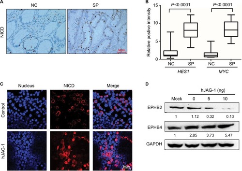 Figure 5 Activation of Notch signaling in serrated neoplasia.Note: (A) Immunohistochemistry staining of NICD in the NC tissue and SP tumor. Magnification, 200×. (B) Real-time PCR determined the downstream target genes of Notch signaling in the NC and SP. (C) Immunofluorescence staining showed the cytonuclear translocation of NICD (red) in SW620 cells treated with 10 ng of recombinant human JAG-1 (hJAG-1) for 24 hours. Cell nuclei were stained using DAPI stain (blue). Magnification, 400×. (D) Protein levels of EPHB2 and EPHB4 in SW620 cells stimulated with increasing dosage of hJAG-1 for 24 hours. Numbers under each blot present the means of three independent analysis and are compared with the mock controls.Abbreviations: hJAG-1, human Jagged1 peptide; GAPDH, glyceraldehyde-3-phosphate dehydrogenase; NC, normal control; NICD, Notch intracellular domain; SPs, serrated polyps.