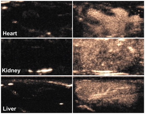 Figure 6 Contrast pulse sequencing-mode images of various organs of normal rats. Images after nanobubble injection (right) showed obvious contrast enhancement in the heart, kidney and liver of Sprague–Dawley rats compared with preinjection images (left).