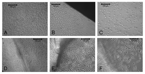 Figure 12. (A) L929 Fibroblast cells. (B) L929 Fibroblast cells in contact with negative control (high density polyethylene), (C) positive control (PVC), (D) 1:1 C-PCLT, (E) 3:2 C-PCLT, (F) 2:1 C-PCLT.