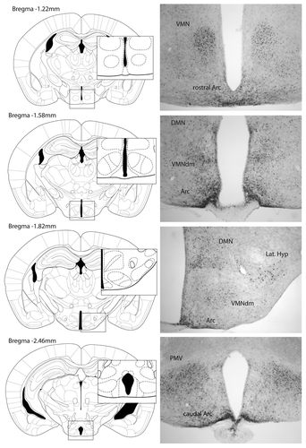 Figure 1. Images show leptin-induced phospho-STAT3 immunohistochemistry in coronal sections of the hypothalamus of fasted female mice treated with an intraperitoneal injection of leptin (1 mg/kg BW).Citation67 Hypothalamic regions displaying leptin-induced phospho-STAT3 include the ventromedial nucleus (VMN), the dorsal medial area of the VMN (VMNdm), arcuate nucleus (Arc), dorsomedial nucleus (DMN), lateral hypothalamus (Lat. Hyp) and ventral premammillary nucleus (PMV).