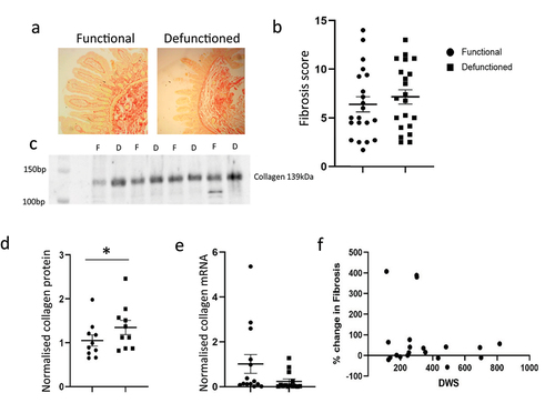 Figure 1. Fibrosis in the functional vs. defunctioned intestine. (a) Representative Sirius red stained sections. (b) Fibrosis scoring in functional (●) vs. defunctioned (■) ileum, n = 21 paired samples, line represents Mean ± SEM. (c) Representative Western blot of Collagen Type 1 in functional (F) vs. defunctioned (D) ileum. (d) Mean ± SEM Type I collagen protein normalized to total protein in functional (●) vs. defunctioned (■) ileum (n = 9 paired samples, *p = 0.03). (e) Mean ± SEM COL1A1 mRNA expression normalized to rplp0 in functional vs. defunctioned ileum (n = 13 paired samples, p = 0.055). F: Days with stoma (DWS) plotted against % change in fibrosis (n = 21, n.S.).