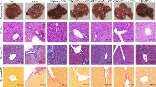 Figure 7. Effects of CRC-CDs on the appearance and pathological changes of liver tissue in mice with carbon tetrachloride-induced liver fibrosis. (A) Appearance of liver tissue, (B) HE staining (× 100), (C) Masson staining (× 100), (D) Sirius red staining (× 100). Mice were assigned into seven groups, namely normal control group (NC), CCl4 group (CCl4), silybin + CCl4 group (silybin + CCl4), high dose of CRC-CDs + CCl4 group (CRC-CDs-H + CCl4), medium dose of CRC-CDs + CCl4 group (CRC-CDs-M + CCl4), low dose of CRC- CDs + CCl4 group (CRC-CDs-L + CCl4) and high dose of CRC-CDs group (CRC-CDs-H).