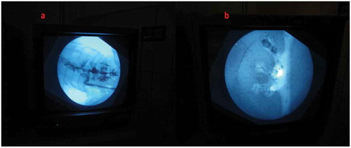 Figure 5. Fluoroscopic view of: (a) Biological model and (b) Non-biological model.