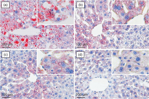 Fig. 4 Lipid staining of the liver sections from high-fat and high-fructose treated mice using Oil Red O staining: (a) model group (0 mg/kg), (b) low-dose group (15 mg/kg), (c) medium-dose group (30 mg/kg), and (d) high-dose group (60 mg/kg).