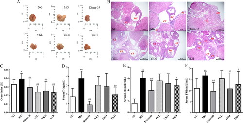 Figure 2. Effect of YK on ovaries tissue of PCOS rats. (A) Ovaries appearance. (B) H&E staining images of the ovaries tissues. (C) Ovary index. (D) Changes in serum T level. (E) Changes in serum FSH level. (F) Changes in serum LH level. CL: Corpus luteum; MF: mature follicle; AF: atretic follicle; CF: cystic follicle. Data are shown as mean ± SD (n = 10). Compared with the NG group, *p < .05, **p < .01, compared with the MG group, #p < .05, ##p < .01.