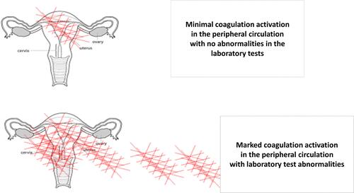 Figure 6 Trophoblast deportation and systemic activation of maternal coagulation cascade. Coagulation system is activated in the placental circulation in the normal pregnant state. This activated coagulation can spill into the peripheral circulation in patients who have obstetrical complications like pre-eclampsia. If coagulation activation in the peripheral circulation becomes uncontrolled, it manifests as DIC.