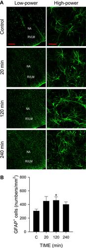 Figure 6 Cadmium increases the number of astrocytes in RVLM. (A) Representative photomicrographs of fluorescence images showing low-power or high-power views of cells in ventrolateral medulla oblongata that were immunoreactive to the reactive astrocyte marker GFAP in rats treated with cadmium (4 mg/kg). (B) Quantitative analysis of GFAP+ immunoreactivity in RVLM using ImageJ. These results are typical of 3 animals from each experimental group. *P < 0.05 vs sham-control (C) group in the Dunnett multiple-range test. Scale bar, 200 μm in low-power view or 20 μm in high-power view images.