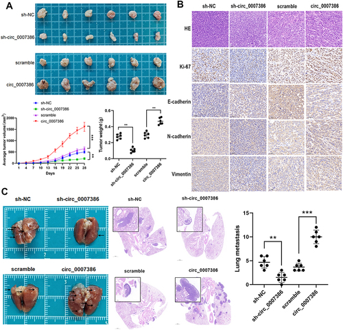 Figure 4 Circ_0007386 promotes the proliferation and metastasis of HCC cells in vivo. (A) Images of subcutaneous xenograft tumors (6 mice per group) in nude mice. The tumor volume and average weight were measured. (B) Immunohistochemical verification of the expression of HE, Ki67, E-cadherin, N-cadherin and Vimentin in tumors tissues. (C) Circ_0007386 stable knockdown or overexpression cells were used to generate lung metastasis. Lung metastatic nodules were stained with HE. The number of metastases was calculated. Data were all showed as mean ± SD; ns indicated no significance, **p < 0.01, ***p < 0.001.