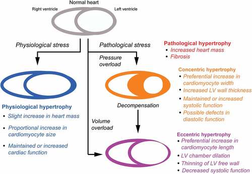 Figure 1. Overview of the hypertrophic response to pathophysiological stress. Although hypertrophy, in general, results in increased cardiomyocyte size and heart mass, the details depend on the nature of the stimulus (e.g. physiological vs. pathological, pressure overload vs. volume overload). Changes associated with physiological remodeling are highlighted in blue. Pathological hypertrophy changes (red) are further defined according to concentric (Orange) and eccentric (purple) types. Modified from ref [Citation21] with permission. Nakamura M and Sadoshima J, Mechanisms of physiological and pathological cardiac hypertrophy. Nat Rev Cardiol 2018;15:387–407.