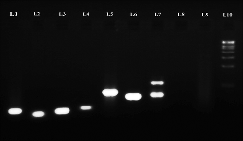 Figure 4. Agarose electrophoregram profile of ITS sequences of endophytic fungal DNA directly from seagrass and cultured fungal DNA amplified using ITS1–ITS4 primers.