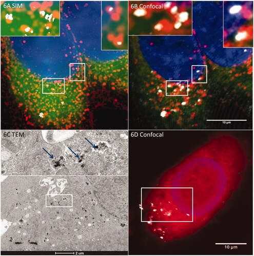 Figure 6. R-SIM provides increased resolution for colocalization studies of metallic (e.g. SPION) NPs. When combined with TEM this can indicate definitive localization. NPs with lysosomes in HeLa cells after an hour-long incubation. (A) Cells imaged with R-SIM, (B) Confocal of SPIONs indicates colocalization with the lysosome, emphasizing the substantial resolution improvement of R-SIM and confirming the findings that a large proportion of NPs colocalize to lysosomal compartments. TEM can also be included in the workflow as described in detail in Guggenheim et al. (Citation2017); an example of a TEM image showing the membrane-bound structures containing SPIONs is indicated in (C) which corresponds to the cell shown in (D).