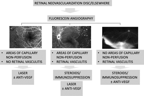 Figure 5. Diagnostic and treating algorithm applied to epiretinal and optic disc neovascularization in uveitis based on fluorescein angiography findings.