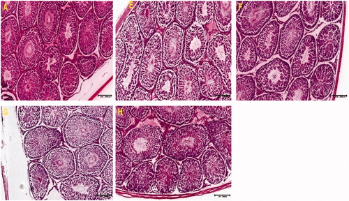 Figure 2. These photomicrographs depict the testicular sections of control and treated rats. The section of control shows well-preserved cytoarchitecture with normal cellular composition in the seminiferous germinal epithelium (GE). The interstitial (I) spaces filled with Leydig cells were normal. The lumen (L) is also populated by immotile spermatozoa (A). Notice thickened basement membrane (BM) with hypoplastic ST with loss of germ cells and hypocellular interstitium in other groups (H&E).