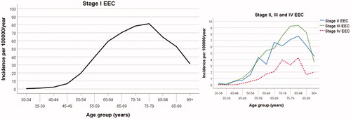 Figure 2. Age-specific incidence rates of endometrioid endometrial carcinoma (EEC) according to stage at diagnosis for the female population of the Western Swedish Health Care Region (1995–2016). The stage-II, stage-III, and stage-IV incidence rates are presented in a separate graph with a magnified scale on the y-axis.