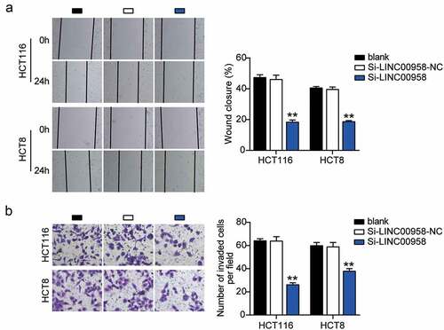 Figure 3. LINC00958 promoted cell migration and invasion of colorectal cancer cells