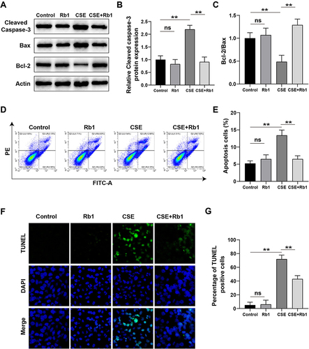 Figure 3 Rb1 ameliorated CSE-induced apoptosis in BEAS-2B cells. (A) Western blot was used to detect the effects of Rb1 on cleaved caspase-3, Bax and Bcl-2 protein expression. (B) Histogram of cleaved caspase-3 protein expression. (C) Histogram of Bcl-2 / Bax protein ratio. (D) Flow cytometry analysis of apoptosis. (E) Apoptosis rate of BEAS-2B cells. (F) TUNEL staining was used to assess the effects of Rb1 on the apoptosis of BEAS-2B cells. (G) Percentage of TUNEL positive cells. **P<0.01.