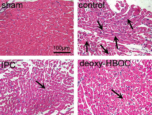 Figure 4. Representative photomicrographs of HE-stained left ventricular tissue sections. Magnification ×400, scale bar: 100 μm. Arrows indicate the locations of acute myocardial necrosis, cellular swelling or fatty changes (n=5).