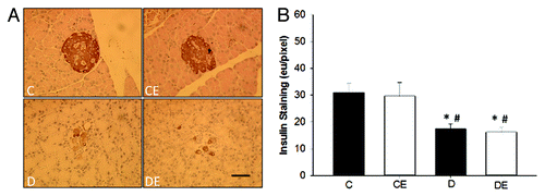 Figure 2. Representative images of pancreatic islet insulin staining (A) and insulin quantification (B). Pancreatic islets from both sedentary and exercised rats with T1DM (D and DE) had significantly less insulin staining than sedentary and exercised non-T1DM (C and CE) rats (P < 0.05). (*) indicates a significant difference from C. (#) indicates a significant difference from CE (P < 0.05). Data are expressed as means ± SE for each animal group. (x40 magnification; Bar = 50 µm)