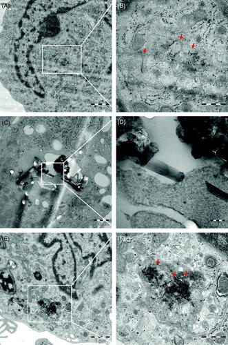 Figure 4. Cellular uptake of MWCNTs. TEM micrographs of HMDMs exposed for 24 h to MWCNTs (10 µg/mL). (A,B) NM400, (C,D) NM401, (E,F) NM402. Scale bars: 1 µm, 500 nm, and 100 nm, as indicated. Arrows in (B) point to individual MWCNT fibers; arrows in (F) point to a tangled agglomerate of fibers. Panel (D) shows NM401 penetrating intracellular membranes. Refer to Figure S3 for light microscopy of HMDMs, and to Figure S7–S9 for results on adherent versus non-adherent neutrophils.