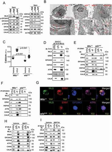 Figure 2. WLS deficiency results in ER stress and the loss of ER quality control. (A) Western blot analysis of UPR sensors, EIF2AK3-ElF2A signals, and calcium regulators in wild-type (+/+), heterozygous (fx/+), and wls-null (fx/fx) Itgax-Cre BMDCs. (B) TEM analysis of the ultrastructure and translational ribosome complex in wild-type and wls-null BMDCs. Red arrow, translational ribosomal complex. (C) intracellular calcium levels in wild-type and wls-null BMDCs following treatment with CCL2 (0.7 nM). (D-F) Western blotting analysis of WLS, ERN1, EIF2AK3, ATF6, HSPA5 CANX, and CALR in anti-WLS, anti-ERN1, and anti-EIF2AK3 immunoprecipitates probed with the respective antibodies in wild-type or wls-deficient BMDCs. Data were generated from three independent experiments. (G) Confocal immunofluorescent imaging of WLS, ERN1, EIF2AK3, and ATF6 in wild-type or wls-null BMDCs. (H-I), Western blot analysis of WLS, ERN1, EIF2AK3, ATF6, HSPA5, CANX, and CALR in anti-WLS immunoprecipitates of BMDCs treated with WNT1 and WNT3A, respectively