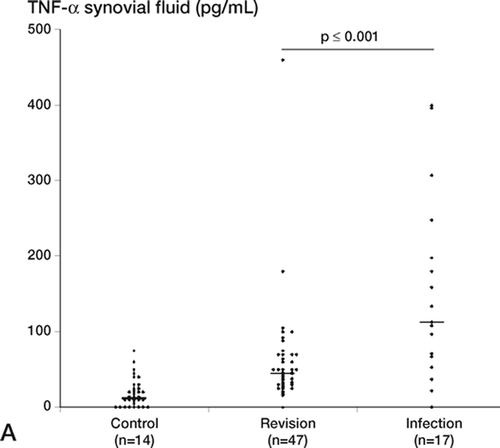 Figure 1. Proinflammatory cytokine levels in synovial fluid (pg/mL), shown for individual patients in the control, revision, and infection groups. For each group, the number of patients is indicated and the median is marked with a horizontal bar. A. Median levels of TNF-α: control group, 12 pg/mL; revision group, 45 pg/mL; infection group, 113 pg/mL. The difference between the revision group and the infected group was statistically significant (p = 0.001). B. Median levels of IL-1β: control group, 22 pg/mL; revision group, 14 pg/mL; infection group, 63 pg/mL. The difference between the revision group and the infected group was statistically significant (p < 0.001). C. Median levels of IL-6: control group, 1450 pg/mL; revision group, 1490 pg/mL; infection group, 10,140 pg/mL. Note log scale. The difference between the revision group and the infected group was statistically significant (p = 0.003).