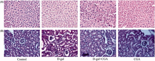 Figure 2. Effect of CGA on histopathological changes of the d-gal-treated mouse liver (A) and kidney (B), (n = 4). Arrow indicated to the structure damage, degeneration, and necrosis of hepatocytes and nephrocytes. Original magnification, 10 × 40.