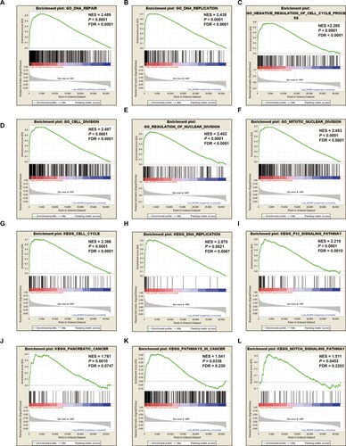 Figure 10 GSEA results of MCM4 in PDAC patients.Notes: (A–F) GSEA results of c2 reference gene sets for high MCM4 expression groups; (G–L) GSEA results of c5 reference gene sets for high MCM4 expression groups.Abbreviations: ES, enrichment score; FDR, false discovery rate; GSEA, gene set enrichment analysis; MCM, minichromosome maintenance; NES, normalized enrichment score; PDAC, pancreatic ductal adenocarcinoma.