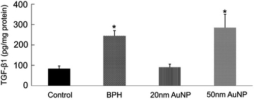 Figure 5 Effect of AuNPs treatment on the prostatic tissue level of TGFβ1. Data represent the mean ± SEM.*P<0.05 compared to the control group.Abbreviations: BPH, benign prostatic hyperplasia; AuNPs, gold nanoparticles; TGF-β1, transforming growth factor-β1.