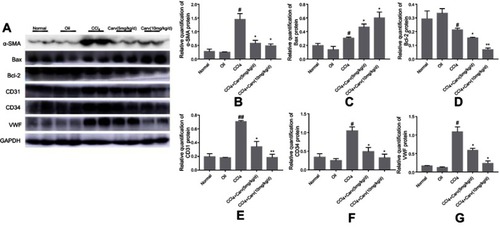 Figure 3 Western blot analyses of α-SMA, Bax, Bcl-2, CD34, CD31 and VWF. (A) Protein expression bands of each index detected by Western blot. (B) The expression of α-SMA was significantly decreased after carvedilol treatment. #P<0.05 vs oil group; *P<0.05 vs CCl4 group. (C) The expression of Bax was increased after carvedilol treatment. #P<0.05 vs oil group; *P<0.05 vs CCl4 group. (D) The expression of Bcl-2 was decreased after carvedilol treatment. #P<0.05 vs oil group; *P<0.05 vs CCl4 group; **P<0.01 vs CCl4 group. (E) The expression of CD31 was decreased after carvedilol treatment. ##P<0.01 vs oil group; *P<0.05 vs CCl4 group; **P<0.01 vs CCl4 group. (F, G) The expression of CD34 and VWF was decreased after carvedilol treatment. #P<0.05 vs oil group; *P<0.05 vs CCl4 group.