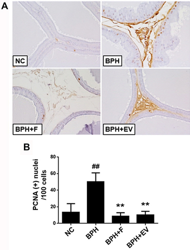 Figure 4 Effects of EV on proliferation in prostatic tissue. (A) Representative prostate tissues immunostained with an anti- proliferative cell nuclear antigen (PCNA) antibody (magnification, ×400). (B) Number of PCNA-positive cells in the prostate. PCNA-positive nuclei were counted in five randomly selected fields (magnification, ×400) from each rat; results are calculated as PCNA-positive nuclei 100 cells−1. NC, corn oil-injected and PBS-treated rats; benign prostatic hyperplasia (BPH), testosterone (3 mg kg−1)-injected and PBS-treated rats; BPH + F, testosterone-injected and finasteride (10 mg kg−1)-treated rats; BPH + EV, testosterone (3 mg kg−1)-injected and EV (150 mg kg−1)-treated rats. Data are expressed as the mean ± SD. ##p <0.01 compared with the NC group; **p <0.01 compared with the BPH group.