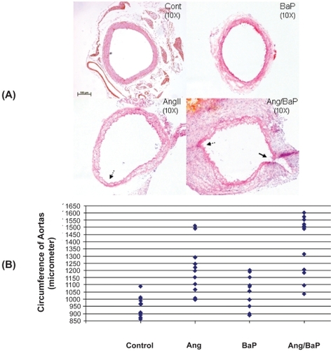 Figure 1 High incidence of AAA formation in C57/B6J mice treated with both AngII and BaP. Representative HE-stained tissue sections of suprarenal segments (1 cm above left renal artery) of the aortas from control and treated mice were shown (A). We measured the circumference of aortic rings from four experimental groups using the computer program of NIH Image J. AAA was defined as circumferences that were increased by more than 50% of the average circumference in the control group (946 ± 69 micrometers). Seven mice from the group treated with both AngII/BaP and two from the AngII-treated group showed AAA formation with circumferences greater than 1417 micrometer (B, each diamond represents a different mouse). Differences in the occurrence of AAA formation between the AngII-treated group and the group treated with both AngII and BaP was statistically significant (P < 0.05). Histology of the aortic wall showed severe damage to the medial layer, breakage of elastic lamella, hematoma, and aortic rupture (indicated by the arrow) in the mouse group treated with both AngII and BaP (A). The aortic wall at the location of rupture was significantly thinner, compared to other parts of the aortic wall. A damaged and thinner aortic wall (broken arrows) was also observed in aortic rings harvested from mice treated with AngII and mice treated with both AngII and BaP.