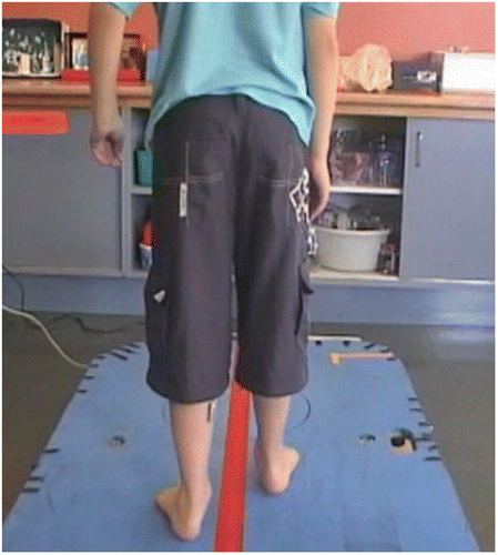 Figure 1. Semi-tandem frontal plane dynamic postural stability testing platform. A child in the semi-tandem stance on the unstable platform, balancing. The rocking movements in the frontal plane.
