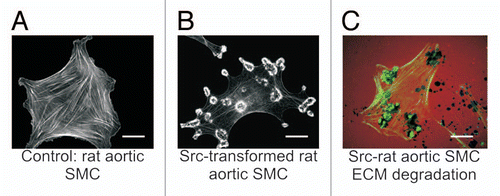 Figure 1 Src-induced formation of podosomes and rosettes in rat aortic smooth muscle cells that actively digest extracellular matrix. (A) A control rat aortic smooth muscle cell (RASMC) showing prominent actin-stress fibers stained with FITC-phalloidin. (B) RASMC line expressing constitutively active Src(Y527F) encoded in retroviral vectors. Note the disappearance of actin-stress fibers and formation of podosomes that self-assemble into rosettes. (C) Digestion of TRITC-labeled fibronectin (red) in ECM by rosettes appears as dark spots. Actin is stained with FITC-phalloidin (green). Scales bars represent 20 µm.