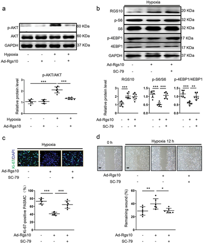 Figure 3. AKT is required for RGS10-mediated regulation of mTORC1 in PASMC. (a) PASMC was transfected with Ad-Con or Ad-Rgs10 and then received normoxia or hypoxia stimulus. The relative expression of p-AKT/AKT in above-treated PASMC was analyzed by immunoblotting (post hoc for LSD test; n = 6 samples per group). (b) PASMC was transfected with Ad-Con or Ad-Rgs10 and then incubated with DMSO or SC-79 before receiving hypoxia stimulus. The relative expression of RGS10, p-S6/S6 and p-4EBP1/4EBP1 in above-treated PASMC was analyzed by immunoblotting (post hoc for LSD test; n = 6 samples per group). (c) above-treated PASMC was stained with Ki-67 (green) and DAPI (blue). Representative images (upper panel) and corresponding quantification of Ki-67-positive PASMC (lower panel) were shown (post hoc for LSD test; n = 6 samples per group). Bar = 50 μm. (d) migration of above-treated PASMC was analyzed by wound healing assay. (post hoc for LSD test; n = 6 samples per group). Bar = 200 μm. Data are shown as mean ± S.D. *P < .05, **P < .01 and ***P < .001 denote statistical comparison between the two marked groups, respectively.