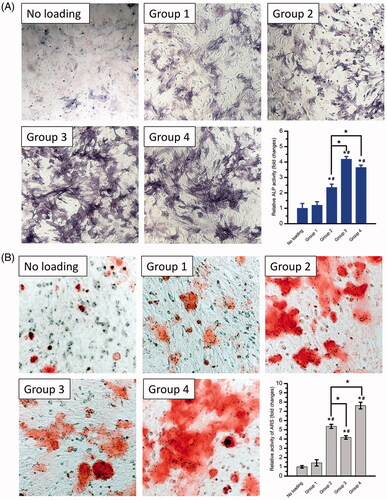 Figure 5. In vitro osteogenesis induced by the GFs-loaded composite hydrogels shown in Table 2. The composite hydrogel Gel/PMs-15 with no growth factor loading labelled as “No loading” was used as a control group. (A) ALP staining (100×) and the quantitative assay after 7 days; (B) Alizarin Red-S staining (100×) and the quantitative assay after 21 days. * and # Indicate statistical significance compared to Group “No loading” and 1, respectively (p < .05); ★ is significant differences between the indicated groups (p < .05).