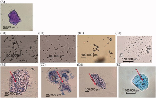 Figure 1. Photo of broiler crop epithelial cell (A), crop epithelial cell (B1), Bacillus velezensis (B2), Bacillus velezensis adhering on the epithelial (C1), Bacillus subtilis (C2), Bacillus subtilis adhering on the epithelial (D1), Saccharomyces cerevisiae (D2), Saccharomyces cerevisiae adhering on the epithelial cell (E1), Debaryomyces hansenii (E2), Debaryomyces hansenii adhering on the epithelial cell.