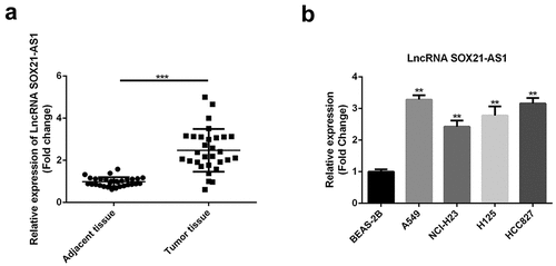 Figure 1. High expression levels of SOX21-AS1 in lung cancer