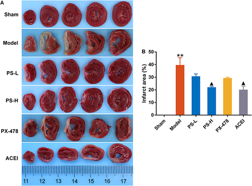 Figure 3 PS reduced myocardial infarct size in rats with AMI. (A) Representative TTC staining images of rats in each group; (B) Quantification of myocardial infarct size. Data were expressed as the mean ± SEM, n=3. **P < 0.01, vs sham group; ▲P < 0.05, vs model group.