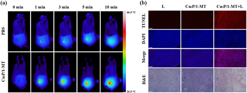 Figure 4 In vivo PTT efficacy. (a) Infrared thermal images of 4T1 tumor-bearing mice under Cu3P/1-MT NPs and laser irradiation. (b) Representative TUNEL and H&E staining images for the primary tumors. Scale bar = 200 μm.