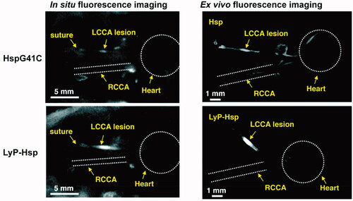 Figure 4. In situ and ex vivo fluorescence imaging of the mice after 48 h of Cy5.5 labeled HspG41C or LyP-Hsp injection. In both the in situ and ex vivo images, the LyP-Hsp injected mouse provided more intense fluorescence signal from the left common carotid artery (LCCA) than the right common carotid artery (RCAA) (adapted from Uchida et al., Citation2011).