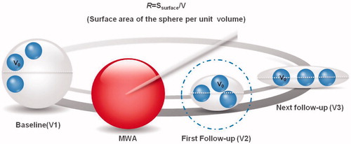 Figure 1. Schematic diagram of index R. Index R was defended as the surface area of the unit volume (R = Ssurface/V). Between the baseline and first follow-up, volume and surface area reduction was observed after effective treatment. The increasing ratio reflected that volume decrease much faster than the surface area. The value of R reflected volume reduction of the lesion. Between the next follow-up the volume had no changes (V2 = V3), while the shape of lesion was different. With the same volume, oblate ellipsoid earned larger surface area. Index R could reflect shape changes. The surface area in per unit volume improved. Dmax of V2, V3 was shorter than V1 after MWA, whereas Dmax in next follow-up was much longer than in first ones. V0: Unit volume (constant); V1: baseline volume; Dmax: white dotted line; V2, V3: volume after MWA, V2 is equal to V3.