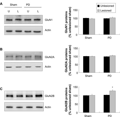 Figure 3 Effect of 6-OHDA on total GluN1/GluN2A/GluN2B proteins of rat striatum.