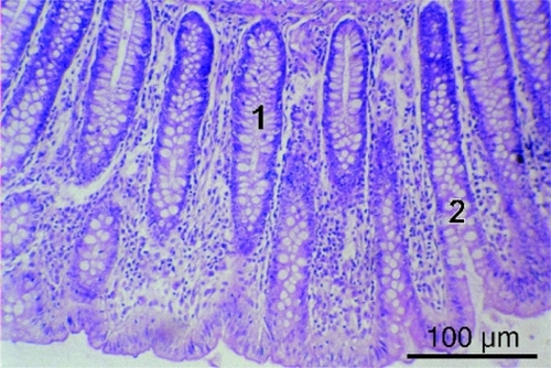 Figure 13 Goblet cells (1), crypts (2) in colon mucosa in IBS patient (hematoxylineosin staining, bar = 100 μm).